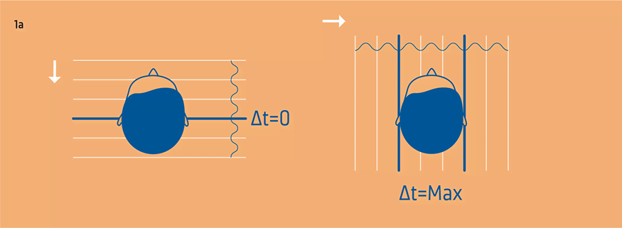 Interaural time difference