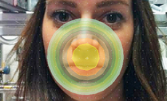 The next stage of studies will focus on speech evaluation and measurement of nasalance